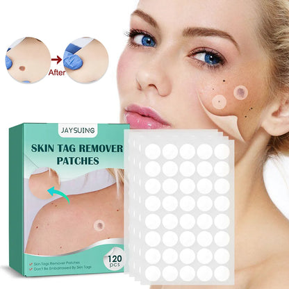 Acne Wart Remover Pimple