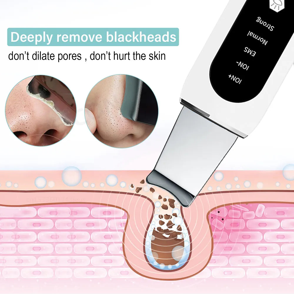 Skin Scrubber Peeling Blackhead Remover